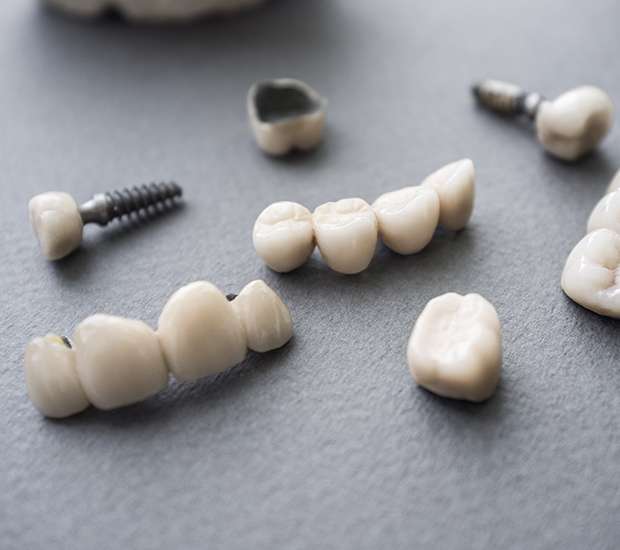 Oakland Park The Difference Between Dental Implants and Mini Dental Implants